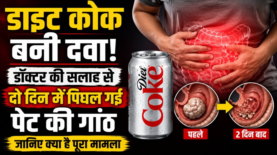 डाइट कोक बनी दवा! डॉक्टर की सलाह से दो दिन में पिघल गई पेट की गांठ, जानिए क्या है पूरा मामला