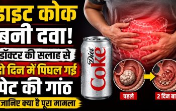 डॉक्टर की सलाह पर डाइट कोक पीने से महिला के पेट की बेजोआर गांठ घुलने का मामला