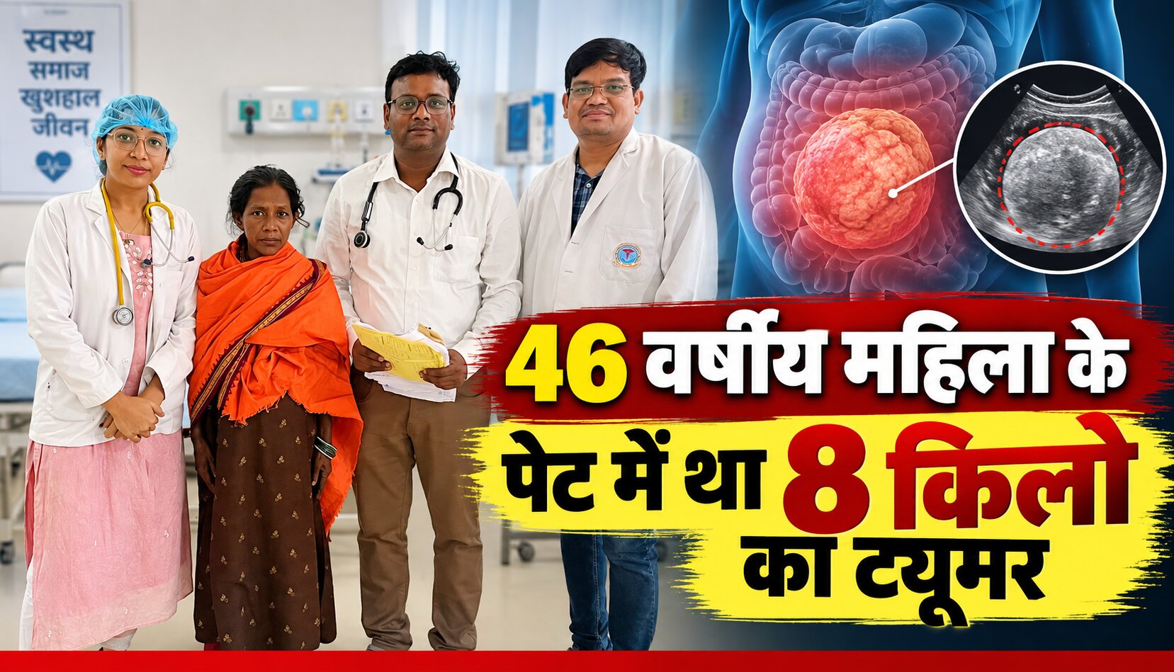 रायगढ़ मेडिकल कॉलेज में 46 वर्षीय महिला के पेट से निकाला गया 8 किलो का विशाल ट्यूमर