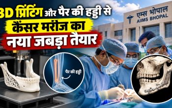 AIIMS भोपाल में 3D प्रिंटिंग और फाइबुला हड्डी से जबड़ा पुनर्निर्माण की सर्जरी