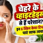 चेहरे के व्हाइटहेड्स से हैं परेशान? इन 6 स्किन केयर टिप्स से पाएं साफ त्वचा