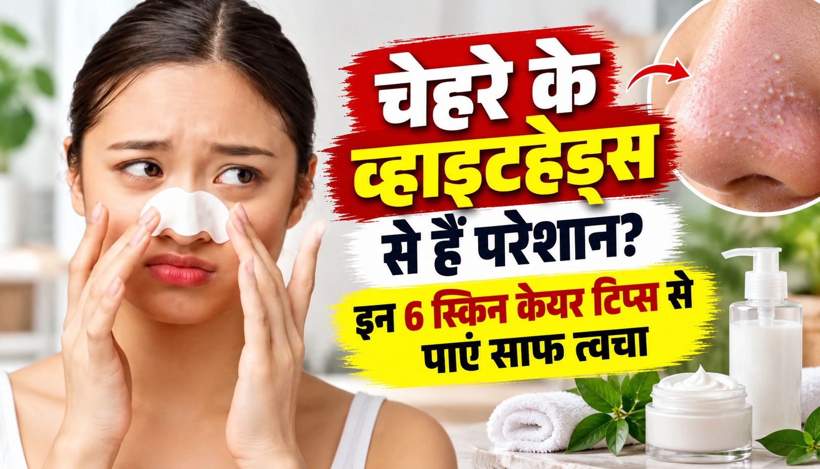 चेहरे के व्हाइटहेड्स से हैं परेशान? इन 6 स्किन केयर टिप्स से पाएं साफ त्वचा