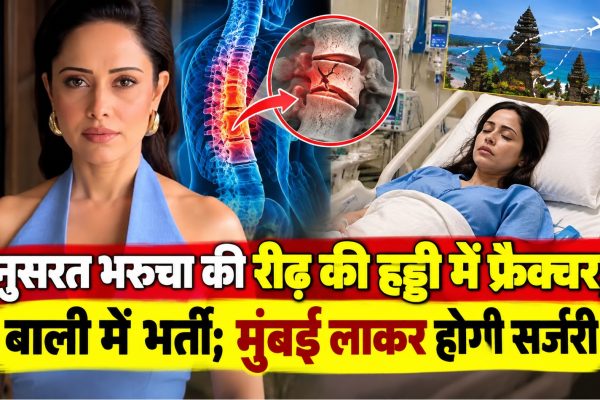 नुसरत भरुचा की रीढ़ की हड्डी में फ्रैक्चर, बाली में भर्ती; मुंबई लाकर होगी सर्जरी