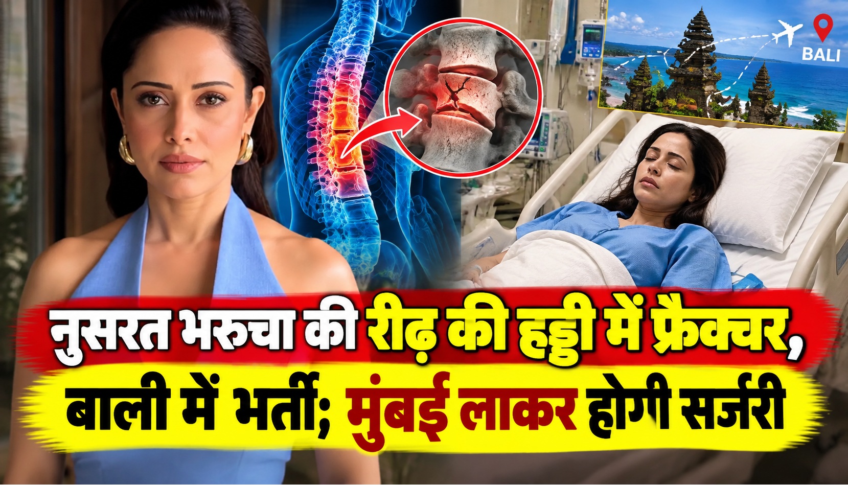 नुसरत भरुचा की रीढ़ की हड्डी में फ्रैक्चर, बाली में भर्ती; मुंबई लाकर होगी सर्जरी